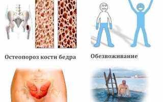 Почему возникает мышечный спазм бедра и как его снять? Полезные советы