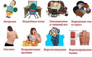 Признаки развития хондроза и методы его лечения для здоровья