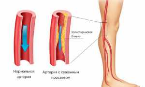 Какая мазь поможет избавиться от онемения конечностей? Полезные советы