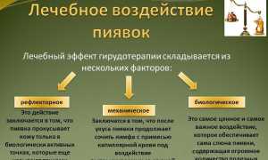 Польза гирудотерапии при подагре и особенности ее проведения для здоровья
