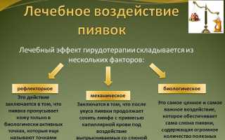Польза гирудотерапии при подагре и особенности ее проведения для здоровья
