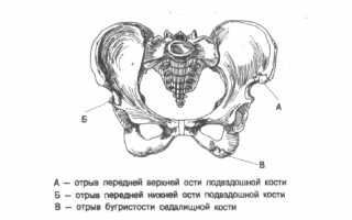 Лечебные меры при переломе подвздошной кости таза: советы и рекомендации