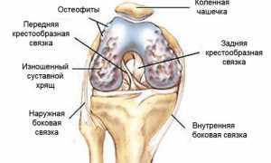 Выполнение упражнений по Бубновскому при гонартрозе для улучшения состояния