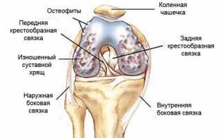 Выполнение упражнений по Бубновскому при гонартрозе для улучшения состояния