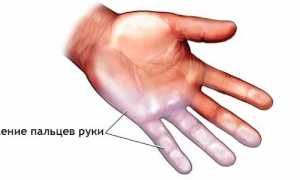 Причины появления онемения безымянного пальца и его последствия