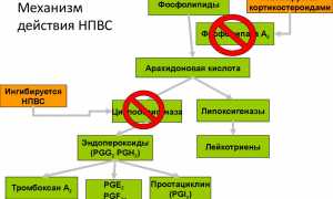 Как выбрать препараты для пожилых от болей в суставах? Полезные советы