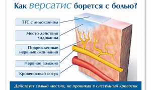 Эффективность применения пластыря Версатис при болях в суставах и мышцах: обзор и рекомендации