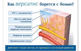 Эффективность применения пластыря Версатис при болях в суставах и мышцах: обзор и рекомендации