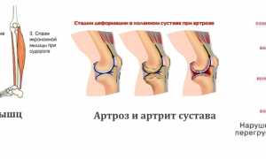 Показания к самомассажу ног и способы его проведения для здоровья