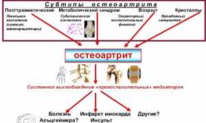 Как применять лекарство РусВиск для эффективного лечения суставов и восстановления?