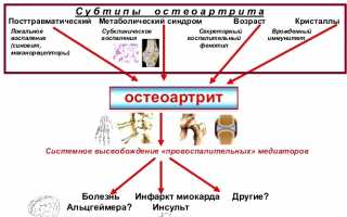 Как применять лекарство РусВиск для эффективного лечения суставов и восстановления?