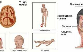 Как долго нужно прикладывать лед при ушибе? Узнайте полезные советы