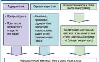 Что такое дискогенная радикулопатия и как ее лечить?