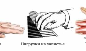 Как лечить гигрому на запястье в домашних условиях? Полезные советы и рекомендации.