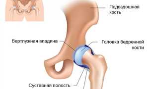 Боли в области тазобедренного сустава при сидении: причины и лечение