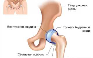 Боли в области тазобедренного сустава при сидении: причины и лечение