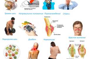 Как определить и чем лечить шейный миозит? Полезные советы и рекомендации
