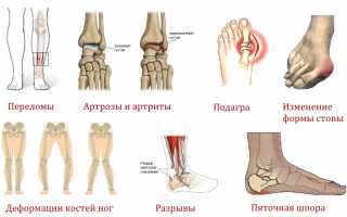 Проведение рентгена ноги и результаты обследования для диагностики