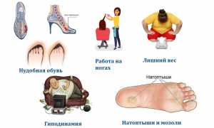 Почему возникают и как устранить боли в ступнях ног? Полезные советы