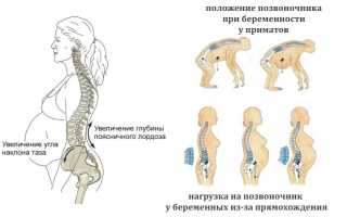 Причины и лечение боли тазовых костей после родов: советы и рекомендации