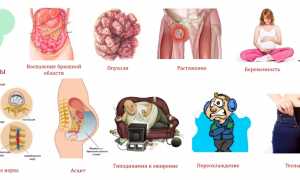 Проявление болезни Рота и способы ее лечения: важные аспекты и рекомендации