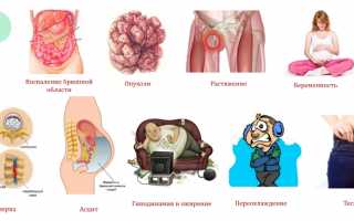 Проявление болезни Рота и способы ее лечения: важные аспекты и рекомендации