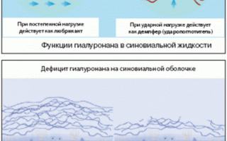 Синокром Форте — препарат для лечения болезней суставов и улучшения подвижности