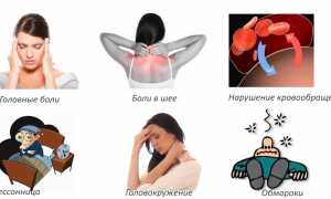 Комплекс упражнений при шейной межпозвоночной грыже для здоровья и восстановления