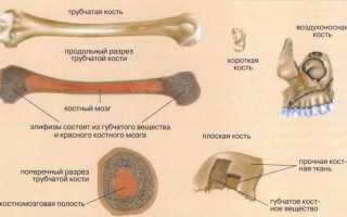 Применение лекарства Фосаванс для лечения остеопороза у пациентов
