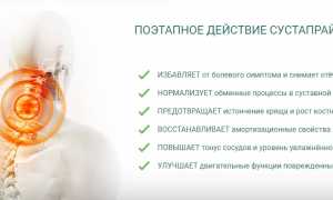 Препарат Сустапрайм — эффективный крем от боли в суставах для улучшения качества жизни