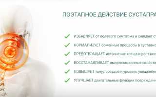 Препарат Сустапрайм — эффективный крем от боли в суставах для улучшения качества жизни