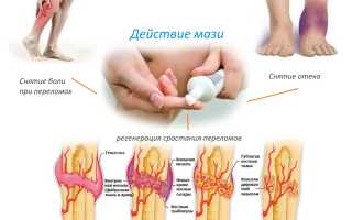 Мази после переломов для восстановления костной ткани и их эффективность