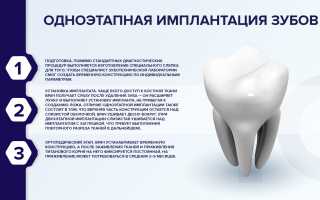 Если я потеряю зуб, каковы преимущества имплантата для здоровья?
