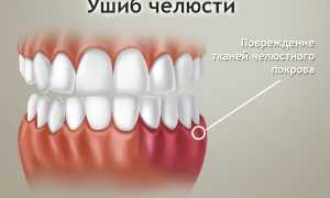 Проявление и способы лечения ушиба челюсти у взрослых