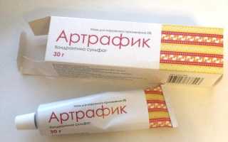 Обзор дешевых заменителей препарата Хондроксид для здоровья суставов