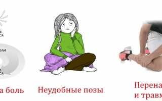 Что такое мышечный гипертонус и почему он возникает? Узнайте больше о причинах и последствиях