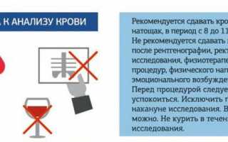 Определение ревматоидного фактора в анализе крови для диагностики заболеваний