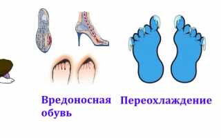 Возникновение онемения большого пальца на ноге: причины и последствия
