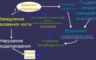 Как лечить постменопаузальный остеопороз? Полезные советы и рекомендации