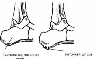 Почему может неметь стопа и как с этим бороться? Полезные советы