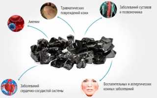 Применение мази Шунгит при заболеваниях суставов и их лечении