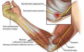 Симптомы неврита локтевого нерва и его лечение: важные аспекты