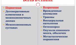 Возникновение болей в позвоночнике посередине спины: причины и лечение