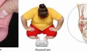 Выполнение массажа при вальгусной стопе у ребенка для улучшения здоровья