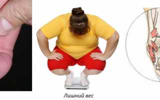 Выполнение массажа при вальгусной стопе у ребенка для улучшения здоровья