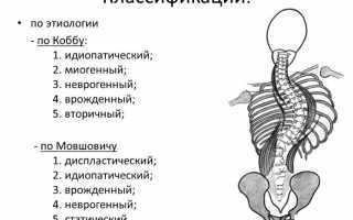 Характерные признаки грудопоясничного сколиоза у взрослых
