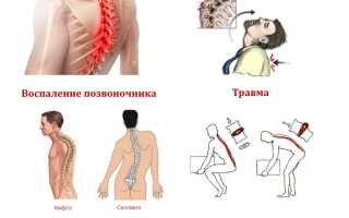 Признаки развития гемангиолипомы позвоночника и ее устранение: важные аспекты и рекомендации
