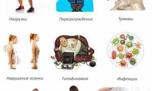 Симптоматические проявления поясничного радикулита и чем его лечить: полезные советы