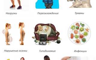 Симптоматические проявления поясничного радикулита и чем его лечить: полезные советы