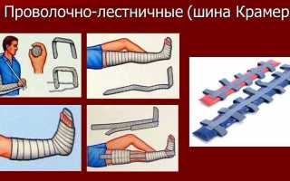 Что такое шина Дитерихса и как ее накладывать? Полное руководство